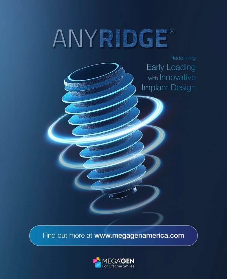 MegaGen AnyRidge Implantat